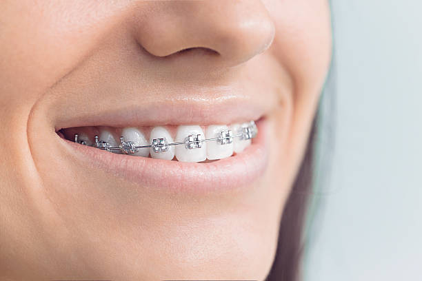 Best Dentures (Full and Partial)  in Redmond, OR